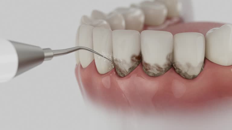 Trusted Teeth Cleaning And Checkup service in Green Meadows, OH - Dentist Open Now